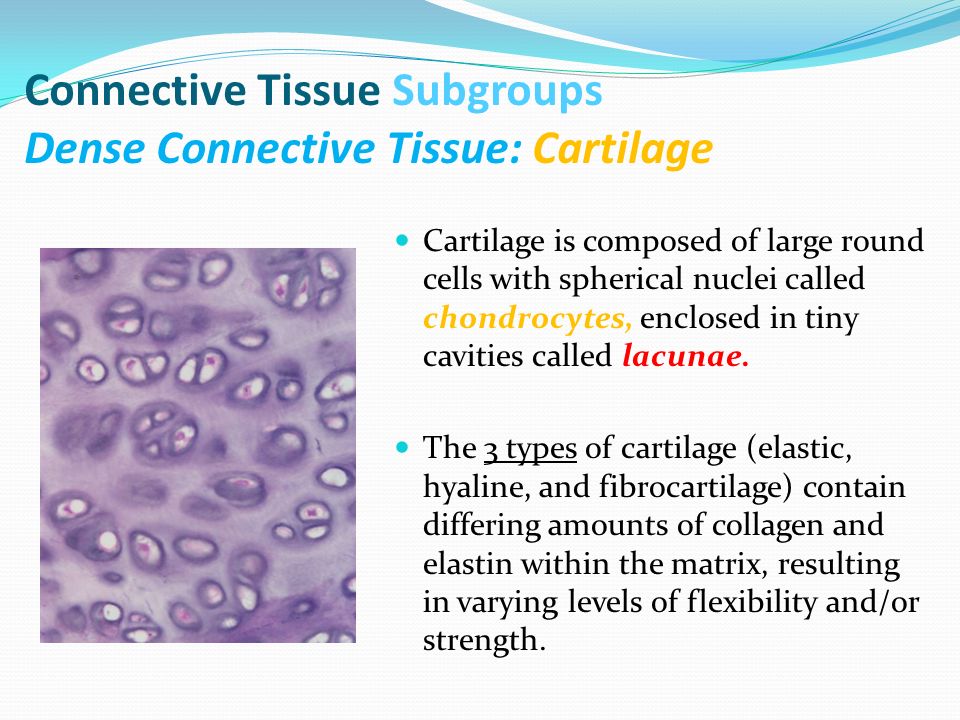 Connective tissue disease